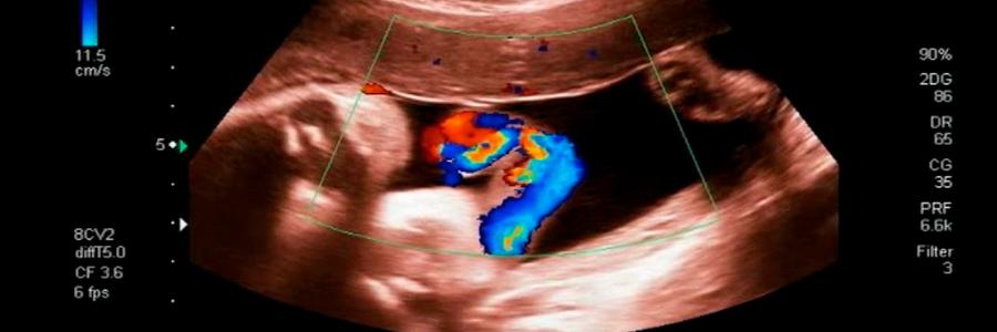ecografia fetal com doppler