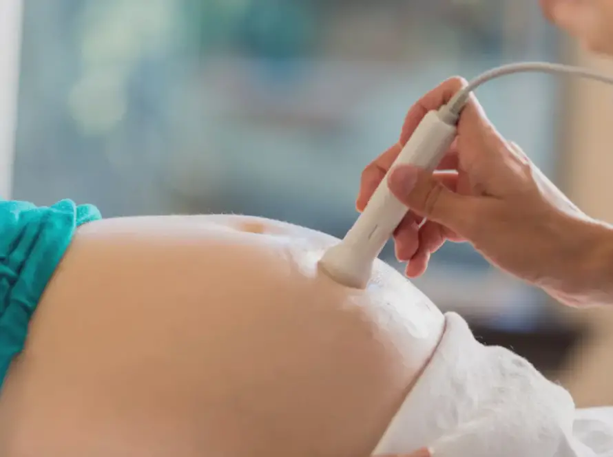 Eco fetal